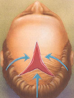 The patterns used in scalp reduction vary widely, yet all meet the goal of bringing hair and scalp together to cover bald areas. 